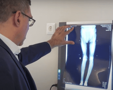 Πλεονεκτήματα Αρθροσπλαστικής ισχίου