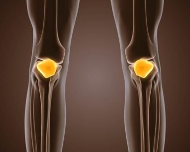 Χονδροπάθεια επιγονατίδας