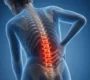 osteoporotika katagmata spondylikis stilis 90x80